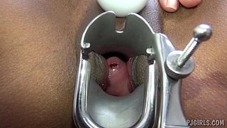 Inspeccionando una vagina con sangre de la regla